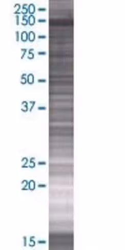 Rbm19 293t cell transient overexpre ssion lysate (denatured) 100 µl