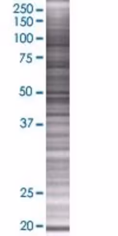 Rbm8a 293t cell transient overexpre ssion lysate (denatured) 100 µl
