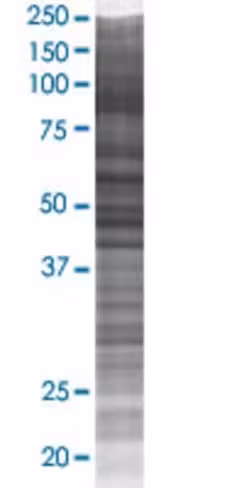 Oxsr1 293t cell transient overexpre ssion lysate (denatured) 100 µl