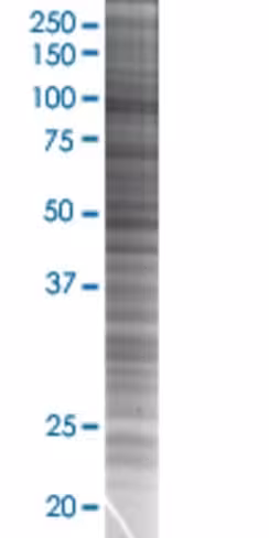 Pdcd6ip 293t cell transient overexp ression lysate (denatured) 100 µl