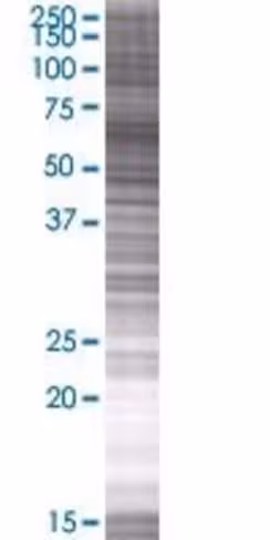 Parp3 293t cell transient overexpre ssion lysate (denatured) 100 µl
