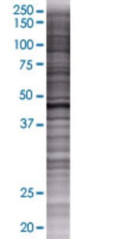 Pdia6 293t cell transient overexpre ssion lysate (denatured) 100 µl