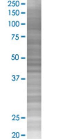 Optn 293t cell transient overexpres sion lysate (denatured) 100 µl