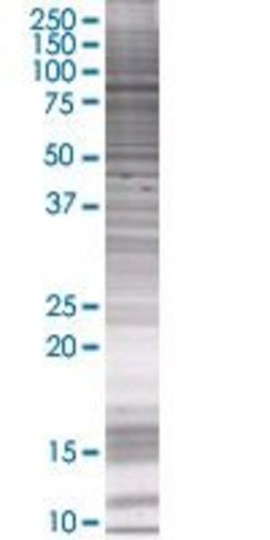 Rbm6 293t cell transient overexpres sion lysate (denatured) 100 µl