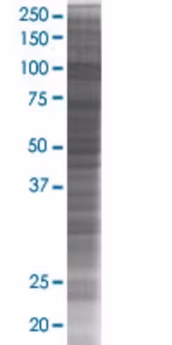 Rbm5 293t cell transient overexpres sion lysate (denatured) 100 µl