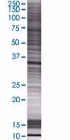 Psmd14 293t cell transient overexpr ession lysate (denatured) 100 µl