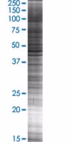 Plin3 293t cell transient overexpre ssion lysate (denatured) 100 µl