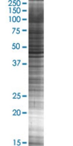 Plin3 293t cell transient overexpre ssion lysate (denatured) 100 µl