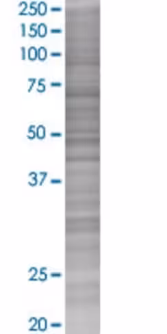 Pop7 293t cell transient overexpres sion lysate (denatured) 100 µl