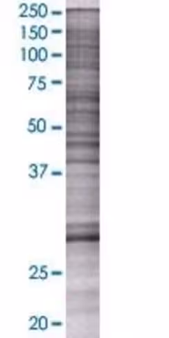 Pcgf3 293t cell transient overexpre ssion lysate (denatured) 100 µl