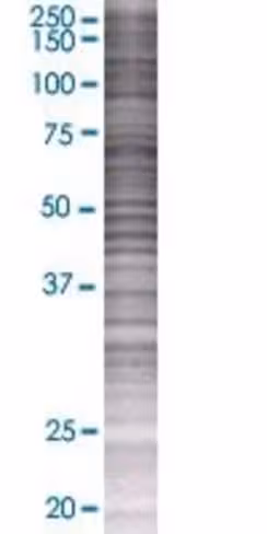 Ppp1r12b 293t cell transient overex pression lysate(denatured) 100 µl
