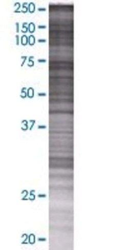 Nvl 293t cell transient overexpress ion lysate (denatured) 100 µl