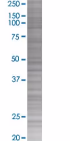 Oas1 293t cell transient overexpres sion lysate (denatured) 100 µl