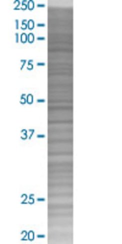 Ogn 293t cell transient overexpress ion lysate (denatured) 100 µl