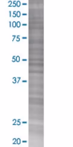 Oprl1 293t cell transient overexpre ssion lysate (denatured) 100 µl