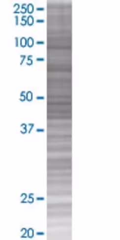 Orc4l 293t cell transient overexpre ssion lysate (denatured) 100 µl