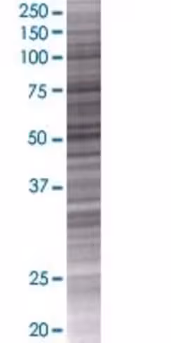 Oxa1l 293t cell transient overexpre ssion lysate (denatured) 100 µl
