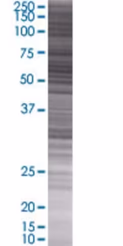 Oxct1 293t cell transient overexpre ssion lysate (denatured) 100 µl