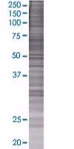 P2rx4 293t cell transient overexpre ssion lysate (denatured) 100 µl