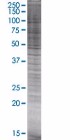 P2rx5 293t cell transient overexpre ssion lysate (denatured) 100 µl