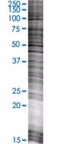 P2ry1 293t cell transient overexpre ssion lysate (denatured) 100 µl