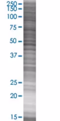 P2ry2 293t cell transient overexpre ssion lysate (denatured) 100 µl