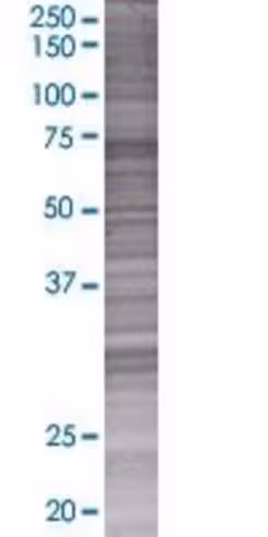 Pc3 293t cell transient overexpress ion lysate (denatured) 100 µl