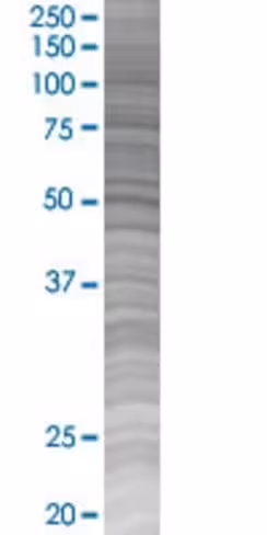 Reg3a 293t cell transient overexpre ssion lysate (denatured) 100 µl