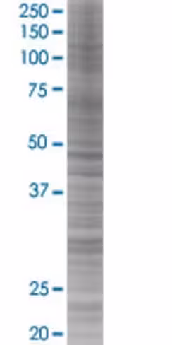 Pax2 293t cell transient overexpres sion lysate (denatured) 100 µl