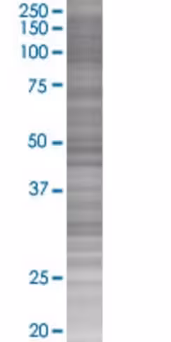 Pax4 293t cell transient overexpres sion lysate (denatured) 100 µl