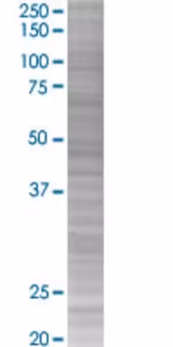 Pck1 293t cell transient overexpres sion lysate (denatured) 100 µl
