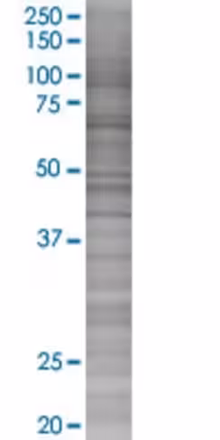 Pck2 293t cell transient overexpres sion lysate (denatured) 100 µl