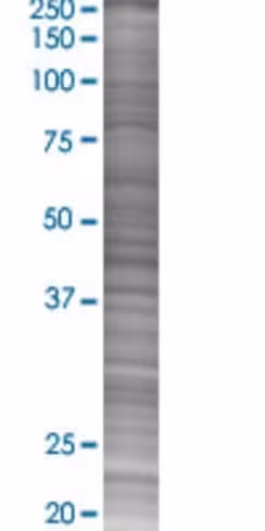 Pcna 293t cell transient overexpres sion lysate (denatured) 100 µl