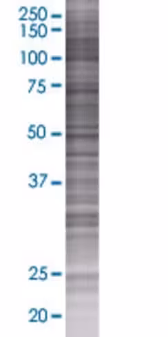 Pcolce 293t cell transient overexpr ession lysate (denatured) 100 µl