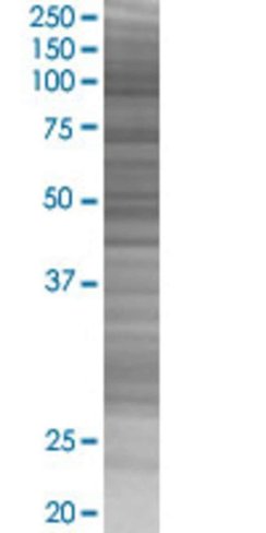 Pcoln3 293t cell transient overexpr ession lysate (denatured) 100 µl