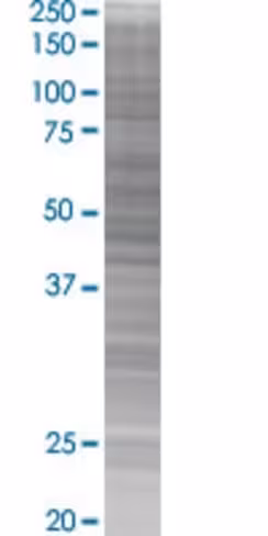 Pctk1 293t cell transient overexpre ssion lysate (denatured) 100 µl