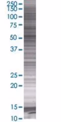 Pctk3 293t cell transient overexpre ssion lysate (denatured) 100 µl