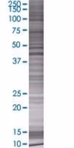 Pdk2 293t cell transient overexpres sion lysate (denatured) 100 µl