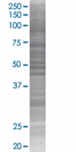 Pdyn 293t cell transient overexpres sion lysate (denatured) 100 µl