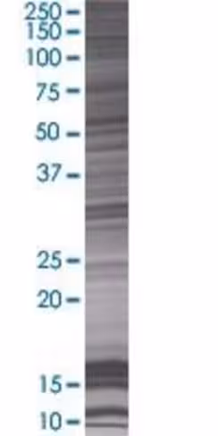 Pepd 293t cell transient overexpres sion lysate (denatured) 100 µl