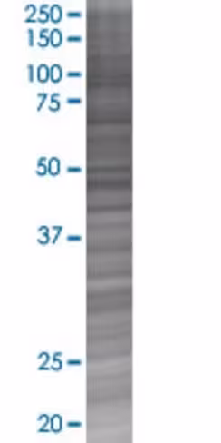 Per1 293t cell transient overexpres sion lysate (denatured) 100 µl