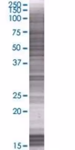 Pex14 293t cell transient overexpre ssion lysate (denatured) 100 µl