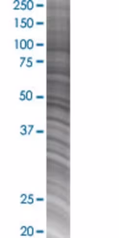 Pf4 293t cell transient overexpress ion lysate (denatured) 100 µl