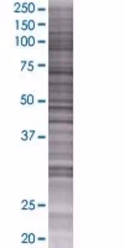 Pfdn2 293t cell transient overexpre ssion lysate (denatured) 100 µl