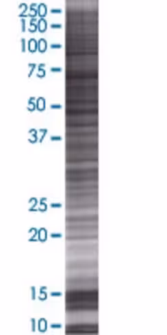 Pfdn5 293t cell transient overexpre ssion lysate (denatured) 100 µl
