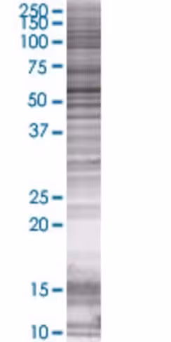Pfkfb3 293t cell transient overexpr ession lysate (denatured) 100 µl