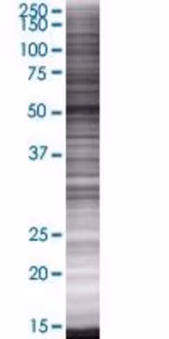 Pgm5 293t cell transient overexpres sion lysate (denatured) 100 µl