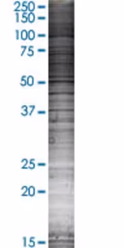 Phex 293t cell transient overexpres sion lysate (denatured) 100 µl