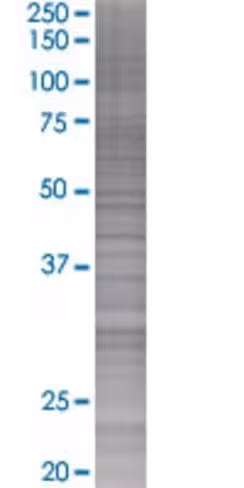 Phf1 293t cell transient overexpres sion lysate (denatured) 100 µl