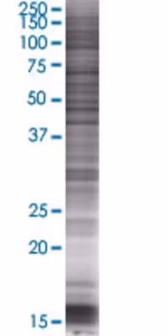 Pigh 293t cell transient overexpres sion lysate (denatured) 100 µl